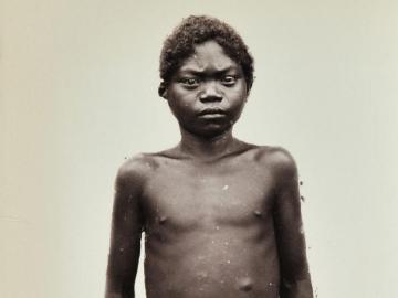 Negrito portrait — Southeast Asia